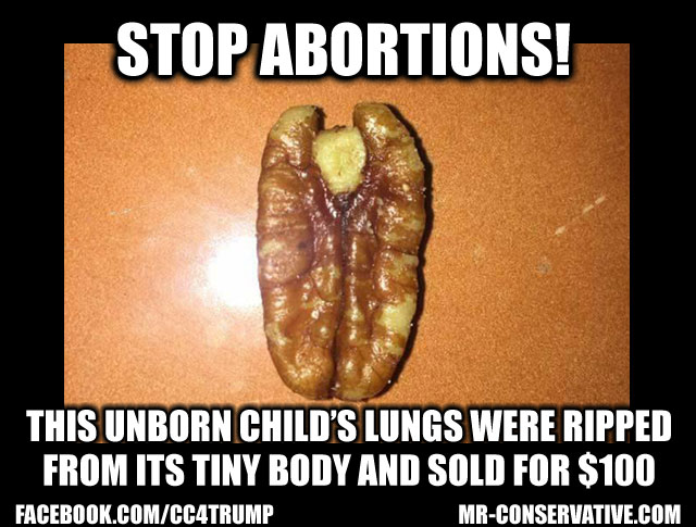 planned parenthood selling baby parts abortion