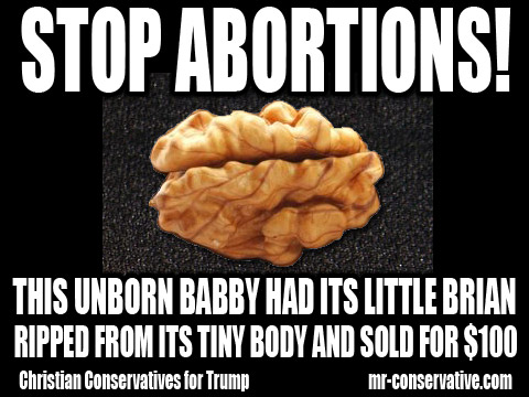 body parts planned parenthood abortion