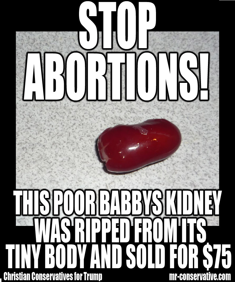 abortion planned parenthood selling baby body parts